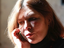 Журналистка Первого канала, избитая майором полиции, подаст на него в суд