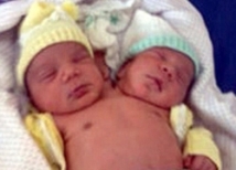 Бразильянка родила здорового двухголового младенца 